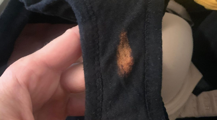 Illustrative example of bleach patch in underwear