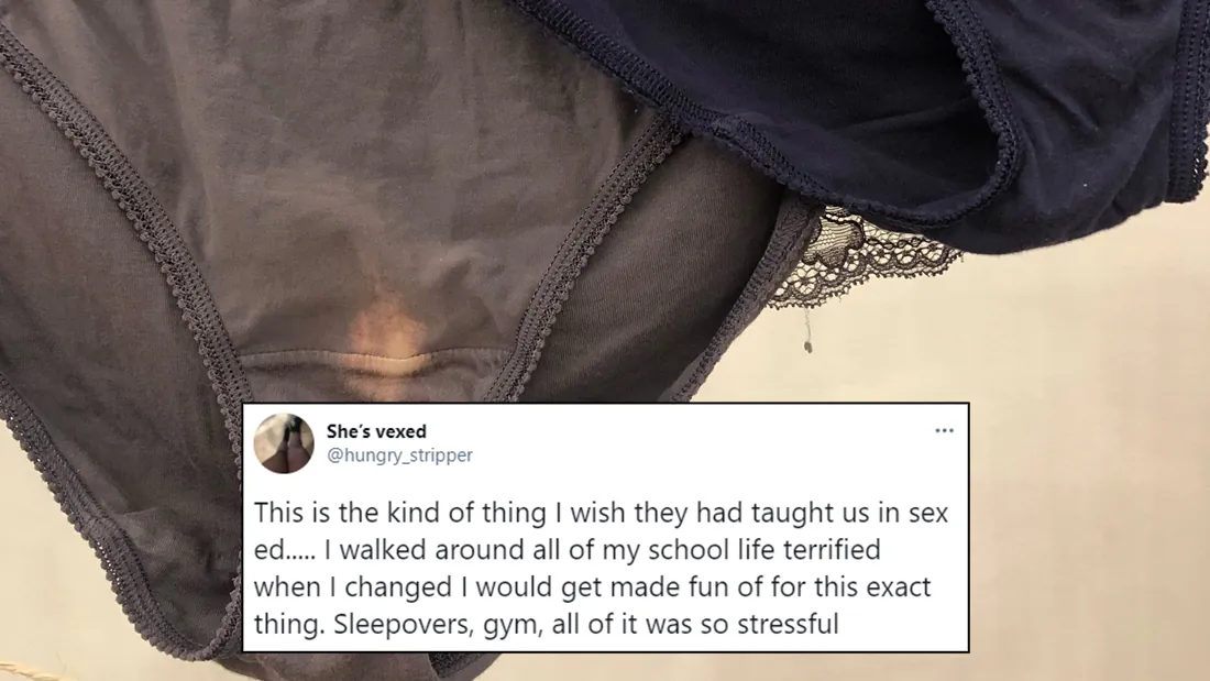 Illustrative example of bleached patches on underwear