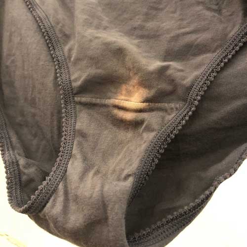 Illustrative example of bleached spots in underwear