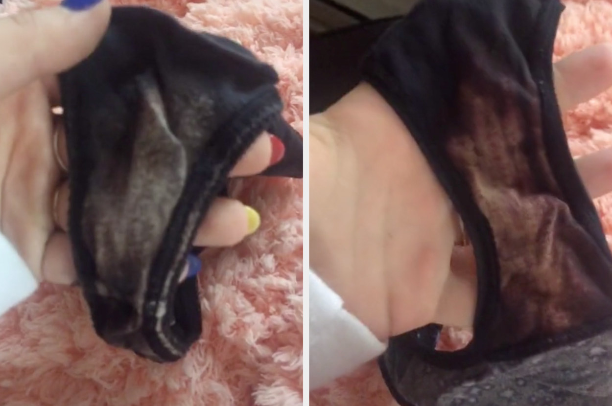 Illustrative example of bleached stain in underwear