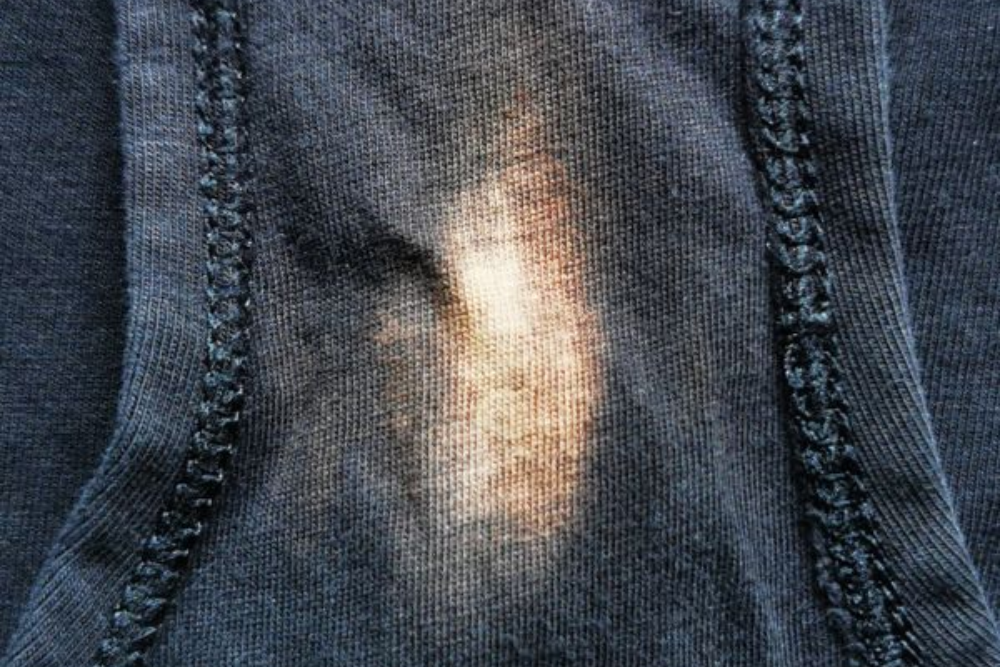 Illustrative example of stain in underwear