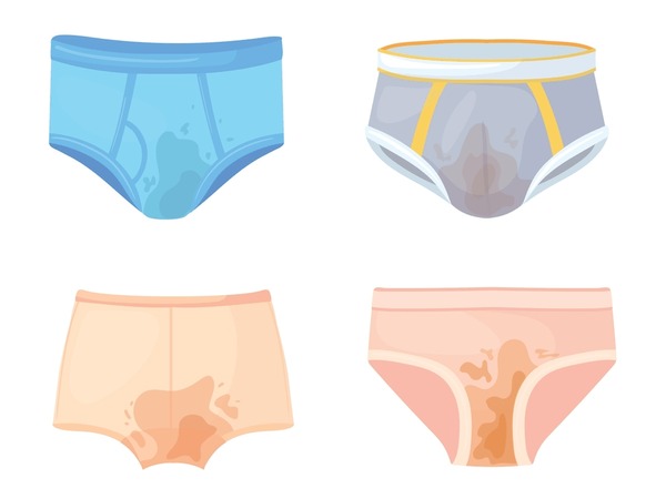 Illustrative example of urine stains on underwear